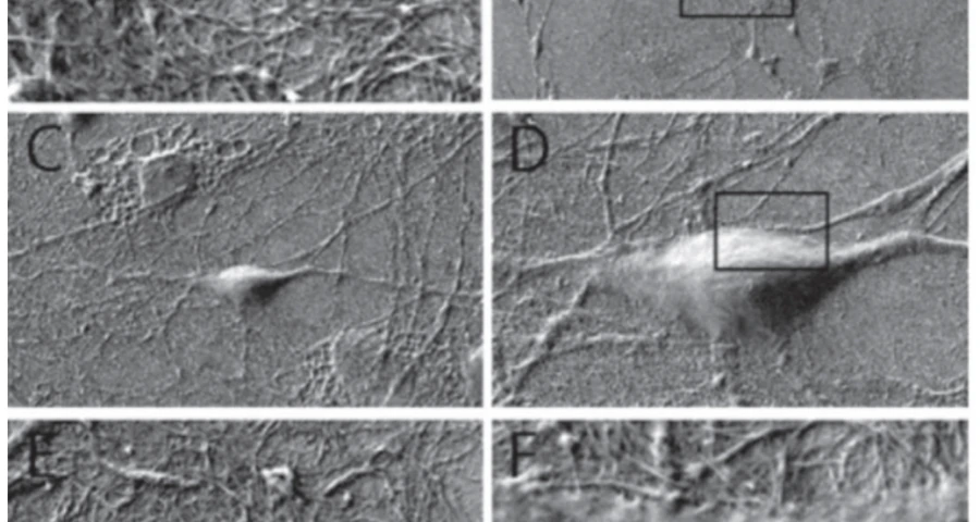 Nuevas evidencias de nanotubos de carbono con cuentas a base de perlas de grafeno líquido y grafito policristalino