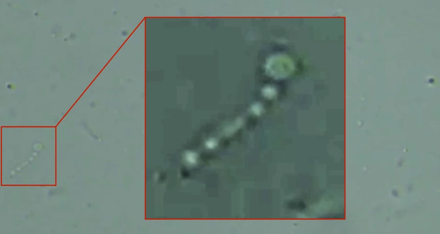 Identificación de patrones en vacunas de c0r0n@v|rus: nano-gusanos coloidales autopropulsados y su relación con las burbujas de PVA